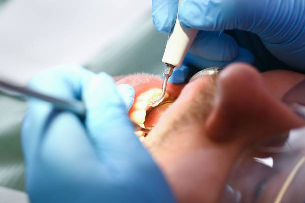 Best Emergency Dental Extractions in Tyrone, GA