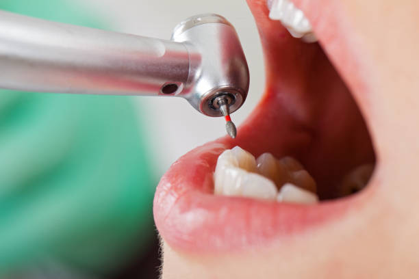 Best Emergency Dentist for Knocked-Out Tooth in Tyrone, GA